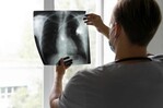 La nueva era del diagnóstico temprano para el cáncer de pulmón La nueva era del diagnóstico temprano para el cáncer de pulmón