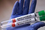 Suben a once los casos de hantavirus, pero la OMS descarta riesgo elevado