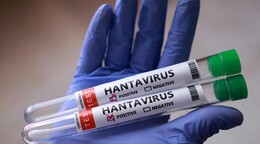 Argentina halla hantavirus en Tierra del Fuego sin nexo con brote del crucero Hondius