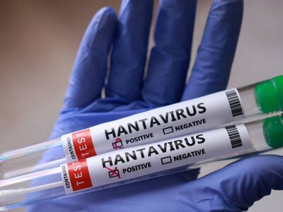 La OMS eleva a 11 los casos de hantavirus