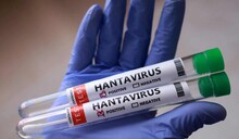 Espa&ntilde;a, Francia y Pa&iacute;ses Bajos adquieren un tratamiento experimental contra el hantavirus