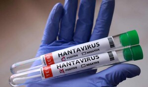 Espa&ntilde;a, Francia y Pa&iacute;ses Bajos adquieren un tratamiento experimental contra el hantavirus