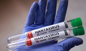 Hantavirus revela que Latinoam&eacute;rica no est&aacute; preparada, advierte comentario de The Lancet