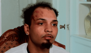 Dominicano denuncia que fue detenido por error y golpeado por agentes de ICE en el Bronx