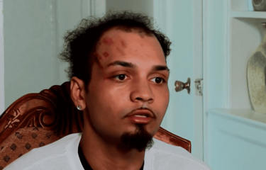 Dominicano denuncia que fue detenido por error y golpeado por agentes de ICE en el Bronx
