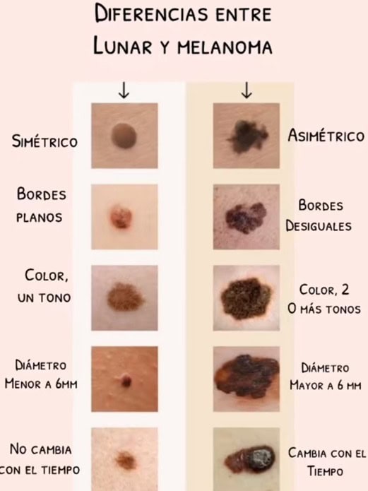 Infograf&iacute;a