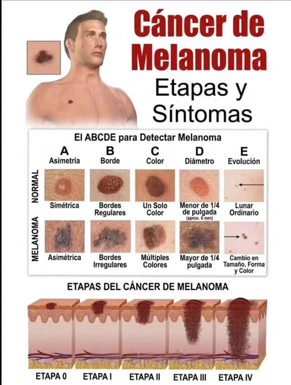 Infograf&iacute;a