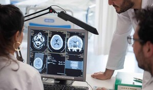 Estudio de Hong Kong halla que la semaglutida mejora la recuperaci&oacute;n tras un ictus grave