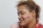 Violencia de pareja deja otra mujer herida en Puerto Plata