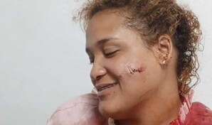 Violencia de pareja deja otra mujer herida en Puerto Plata