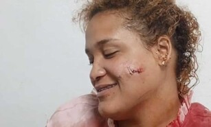 Violencia de pareja deja otra mujer herida en Puerto Plata