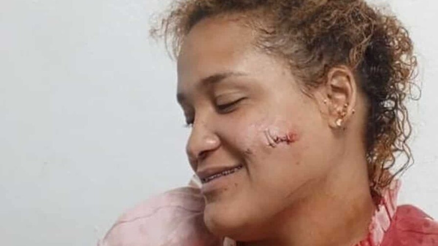 Violencia de pareja deja otra mujer herida en Puerto Plata