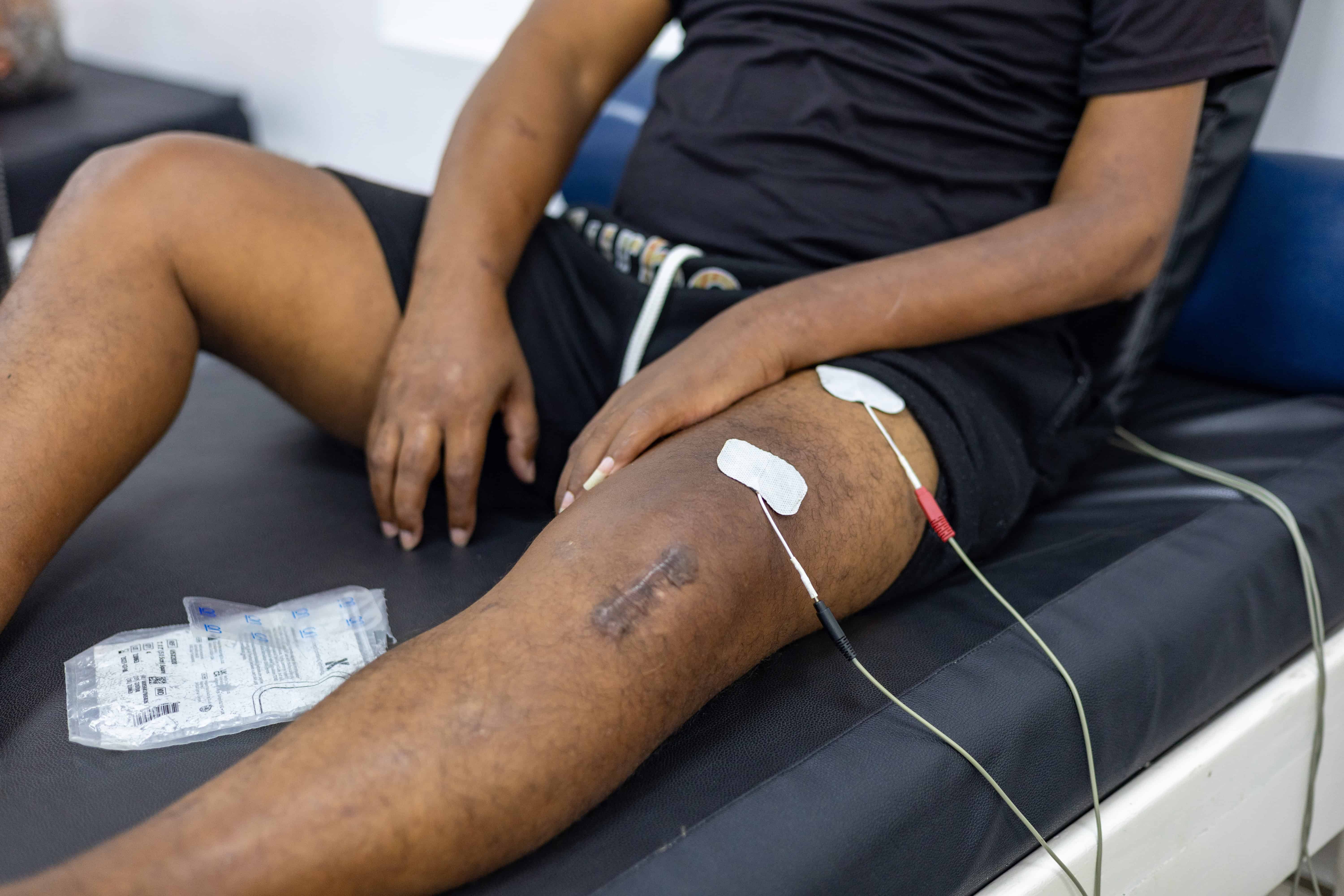 Una moto lo atropell&oacute; provoc&aacute;ndole  fracturas m&uacute;ltiples: f&eacute;mur, tibia y clav&iacute;cula.