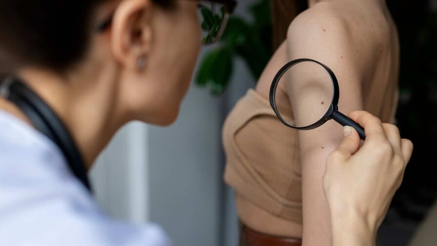 Las señales que la piel da antes del cáncer y muchos ignoran Las señales que la piel da antes del cáncer y muchos ignoran