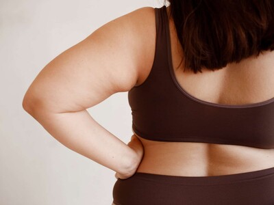 “La obesidad genera más de 200 complicaciones asociadas”, advierten