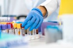 Desarrollan un test para detectar el cáncer de páncreas mediante una muestra de sangre Desarrollan un test para detectar el cáncer de páncreas mediante una muestra de sangre