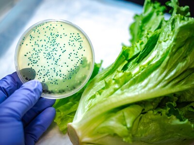 OMS revela que contaminación alimentaria provoca 1.5 MM de muertes
