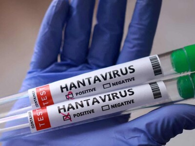 Reino Unido confirma un caso positivo de hantavirus