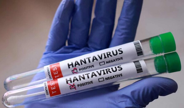 Reino Unido confirma un caso positivo de hantavirus en la remota isla de Trist&aacute;n de Acu&ntilde;a