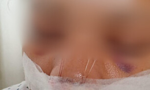 Denuncian mujer fue sometida a cirug&iacute;a tras brutal ataque de indigente en la autopista Duarte