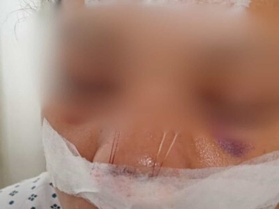 Denuncian agresión a mujer en la calle por indigente agresor