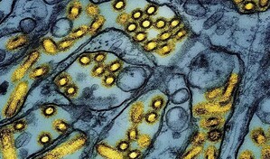 Australia detecta el primer caso de gripe aviar H5 en su territorio continental