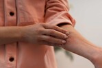 Dermatitis por calor: c&oacute;mo reconocerla y prevenirla