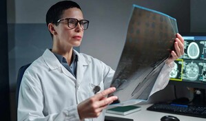 Tumores cerebrales benignos tambi&eacute;n pueden comprometer funciones vitales
