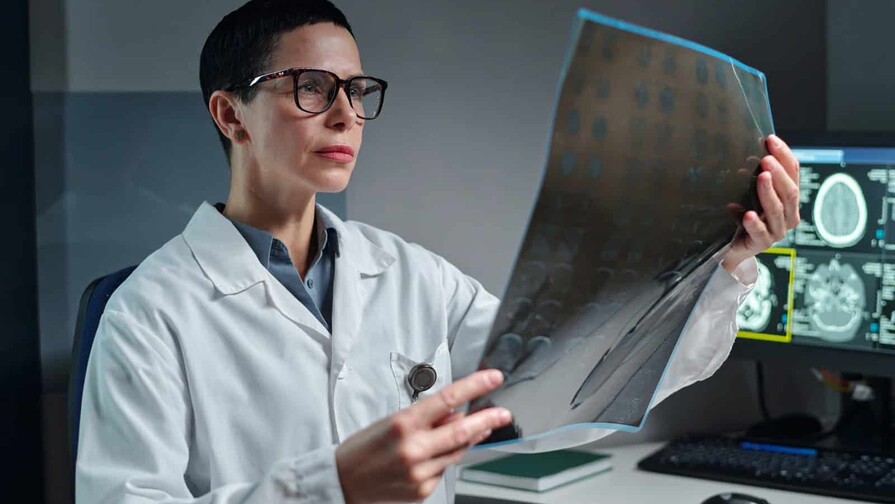 Tumores cerebrales benignos tambi&eacute;n pueden comprometer funciones vitales