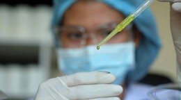 Aclaran un misterio de d&eacute;cadas sobre c&oacute;mo los par&aacute;sitos de la malaria invaden las c&eacute;lulas