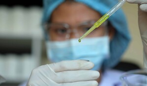 Aclaran un misterio de d&eacute;cadas sobre c&oacute;mo los par&aacute;sitos de la malaria invaden las c&eacute;lulas