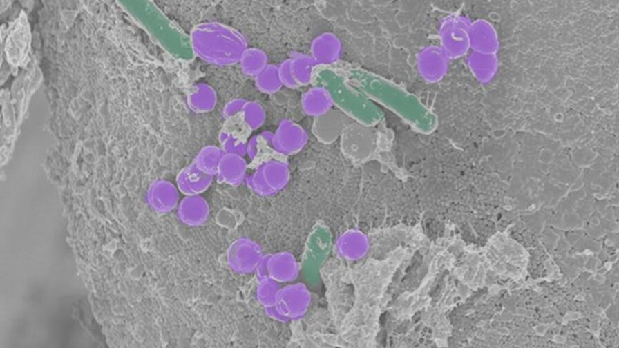 Científicos en EE. UU. desarrollan la primera célula sintética capaz de crecer y reproducirse Científicos en EE. UU. desarrollan la primera célula sintética capaz de crecer y reproducirse