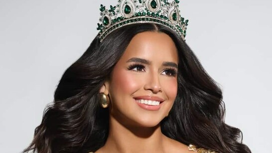 Modelo Venezolana Skarlent Rodr guez V ctima De Los Terremotos modelo-venezolana-skarlent-rodr-guez-v-ctima-de-los-terremotos
