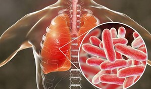 El brote de legionela en Nueva York deja 59 afectados y 15 hospitalizados