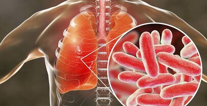 El brote de legionela en Nueva York deja 59 afectados y 15 hospitalizados