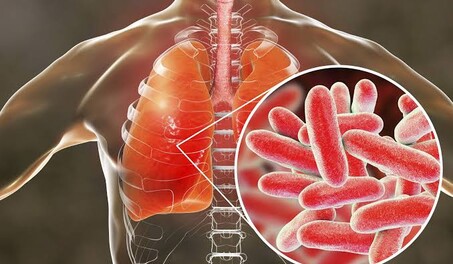 El brote de legionela en Nueva York deja 59 afectados y 15 hospitalizados