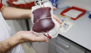 Transfusi&oacute;n de sangre: la de un familiar directo no es la mejor