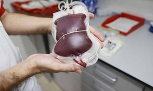 Transfusi&oacute;n de sangre: la de un familiar directo no es la mejor