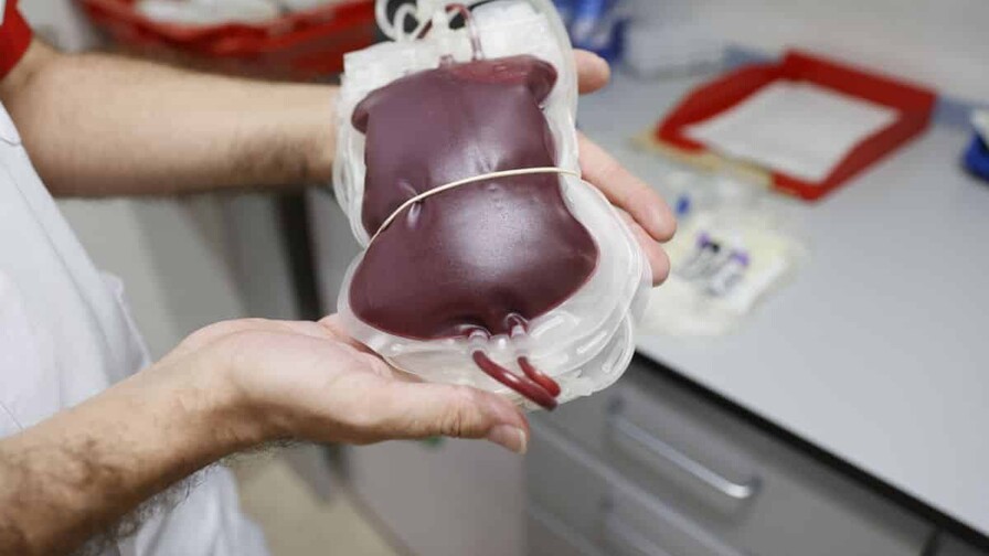 Transfusi&oacute;n de sangre: la de un familiar directo no es la mejor