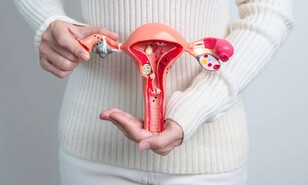 La endometriosis quiz&aacute;s no empiece en el &uacute;tero