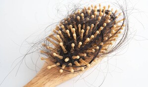 ¿Se te cae el cabello después del parto? Lo que debes saber sobre la alopecia postparto
