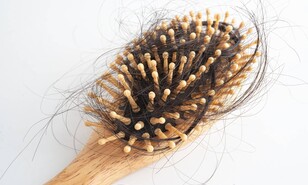 &iquest;Se te cae el cabello despu&eacute;s del parto? Lo que debes saber sobre la alopecia postparto