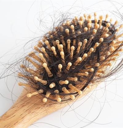 &iquest;Se te cae el cabello despu&eacute;s del parto? Lo que debes saber sobre la alopecia postparto