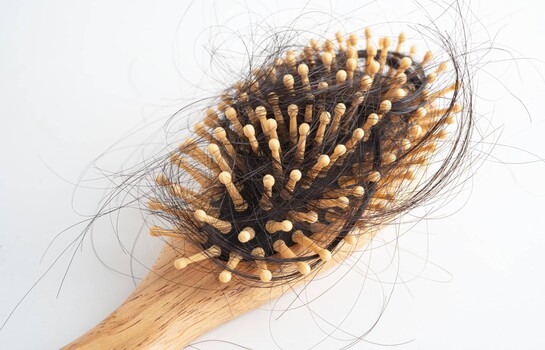 &iquest;Se te cae el cabello despu&eacute;s del parto? Lo que debes saber sobre la alopecia postparto