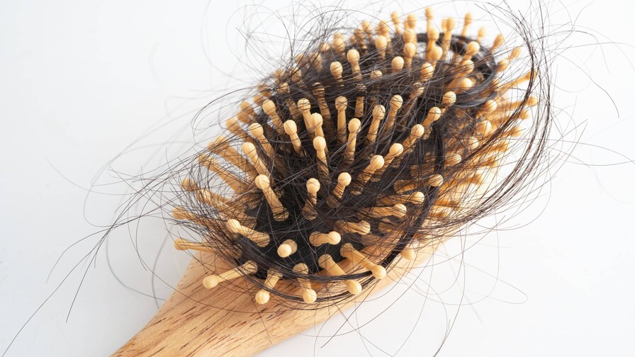 ¿Se te cae el cabello después del parto? Lo que debes saber sobre la alopecia postparto ¿Se te cae el cabello después del parto? Lo que debes saber sobre la alopecia postparto