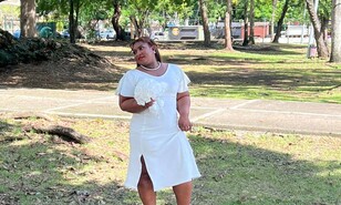 La traves&iacute;a de Rebecca Brizard para una cirug&iacute;a est&eacute;tica que termin&oacute; en su muerte
