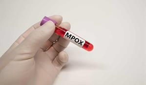Qu&eacute; pasa con la Viruela S&iacute;mica (MPox) en la Rep&uacute;blica Dominicana