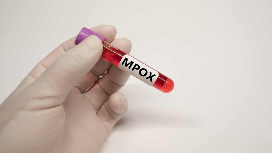 Qu&eacute; pasa con la Viruela S&iacute;mica (MPox) en la Rep&uacute;blica Dominicana