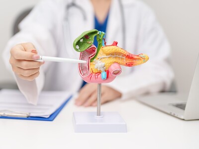 FDA aprueba Rasonque para cáncer de páncreas