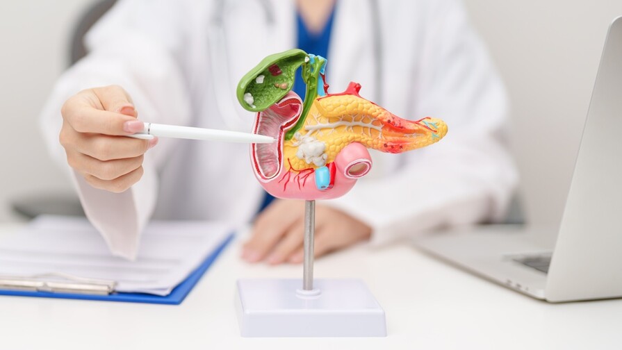 EE. UU. aprueba prometedor tratamiento para cáncer de páncreas EE. UU. aprueba prometedor tratamiento para cáncer de páncreas